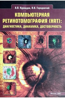 Компьютерная ретинотомография (HRT): диагностика динамика достоверность. Куроедов А.В. Городничий В.В.