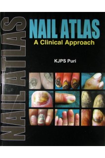 Nail Atlas: A Clinical Approach 1st Edition. K.J.P.S. Puri