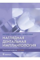 Наглядная дентальная имплантология (предназначено студентам ординаторам и стоматологам всех специальностей). Жак Мале Фрэнсис Мора Филипп Бушар ; пер. с англ. под ред. А.М. Панина
