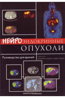 Нейроендокринні пухлини: керівництво. Кэплин М. Кволс Л.