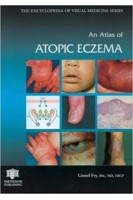 An Atlas of Atopic Eczema (Encyclopedia of Visual Medicine Series). Lionel Fry
