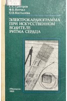 Электрокардиограмма при искусственном водителе ритма сердца (БУ). Григоров С.С.