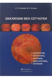 Окклюзии вен сетчатки: методические рекомендации.. Астахов Ю.С Тульцева С.Н.