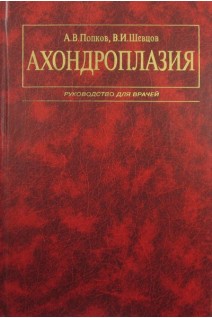 Ахондроплазия. Попков А.В. Шевцов В.И.