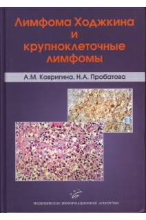 Лимфома Ходжкина и крупноклеточные лимфомы. Ковригина А.М. Пробатова Н.А.