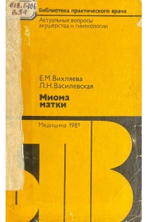 Миома матки (БУ). Вихляева Е.М.