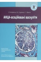 АНЦА-асоційовані васкуліти. Катеренчук І.П. Гуцаленко О.О. Ярмола Т.І.
