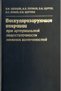 Васкуляризирующие операции при артериальной недостаточности нижних конечностей. Шевцов И.П. Дьячкова Г.В. Попков А.В.