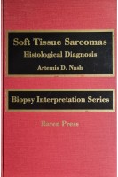 Soft Tissue Sarcomas: Histological Diagnosis. Artemis D. Nash