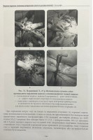 Лікування поранених з бойовими ушкодженнями живота (за досвідом АТО/ООС) (ч/б). за заг. ред. Цимбалюка В.І.