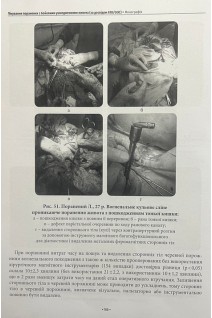 Лікування поранених з бойовими ушкодженнями живота (за досвідом АТО/ООС) (ч/б). за заг. ред. Цимбалюка В.І.