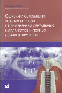 Ошибки и осложнения лечения больных с применением дентальных имплантов и полных съемных протезов. Шашмурина В.Р.