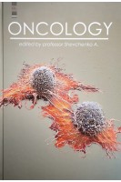 Oncology (Онкологія): підручник. Shevchenko A. (Шевченко А.І.)