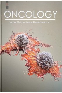 Oncology (Онкологія): підручник. Shevchenko A. (Шевченко А.І.)