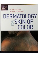Dermatology for Skin of Color. A. Paul Kelly and Susan Taylor