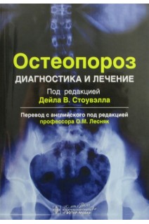 Остеопороз. Диагностика и лечение. Стоувэлл Дейл В.