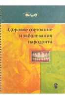 Здоровое состояние и заболевания пародонта. Атлас (БУ)