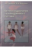 Остеохондропатия тазобедренного сустава. Шевцов И.П. Дьячкова Г.В. Попков А.В.