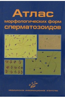 Атлас морфологических форм сперматозоидов. 2-е изд. Гончаров Н.П.