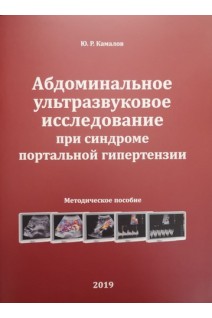 Абдоминальное ультразвуковое исследование при синдроме портальной гипертензии. Камалов А.А.