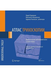 Атлас трихоскопии. Дерматоскопия заболеваний волос и кожи головы. Лидия Рудницкая Мальгожата Ольшевская