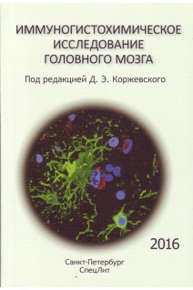 Иммуногистохимическое исследование головного мозга. Коржевский Д.Э