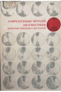 Современные методы диагностики злокачественных опухолей (БУ). Блохин Н.Н.