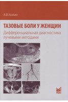 Тазовые боли у женщин. Дифференциальная диагностика лучевыми методами. Холин А.В.