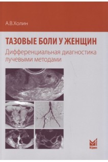 Тазовые боли у женщин. Дифференциальная диагностика лучевыми методами. Холин А.В.