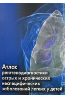 Атлас рентгенодиагностики острых и хронических неспецифических заболеваний легких у детей. Костюченко М.В. Мизерницкий