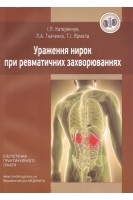 Ураження нирок при ревматичних захворюваннях. Навчальний посібник. Катеренчук І.П. Ткаченко Л.А. Ярмола Т.І.