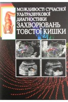Можливості сучасної УЗД захворювань товстої кишки. Гапченко В.В. Абдуллаєв Р.Я. Динник О.Б.