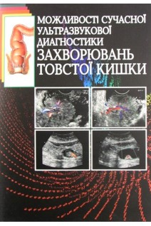 Можливості сучасної УЗД захворювань товстої кишки. Гапченко В.В. Абдуллаєв Р.Я. Динник О.Б.