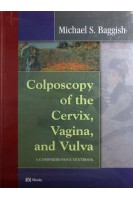 Colposcopy of the Cervix Vagina and Vulva: A Comprehensive Textbook. Michael S. Baggish