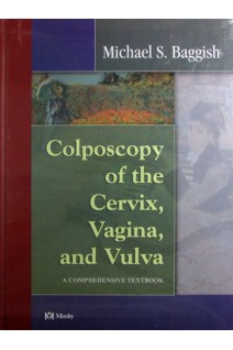 Colposcopy of the Cervix Vagina and Vulva: A Comprehensive Textbook. Michael S. Baggish