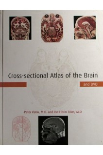 Cross-sectional Atlas of the Brain and DVD. Peter Ratiu and Ion-Florin Talos