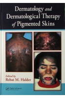 Dermatology and Dermatological Therapy of Pigmented Skins. Rebat Halder