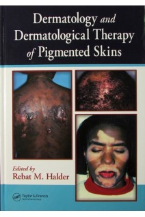 Dermatology and Dermatological Therapy of Pigmented Skins. Rebat Halder
