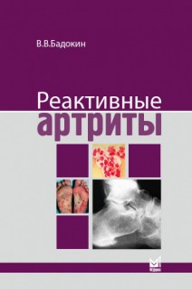 Реактивные артриты. Урогенитальные и постэнтероколитические. Бадокин В.В.