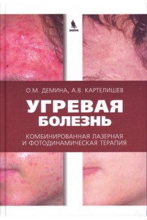Угревая болезнь. Комбинированная лазерная и фотодинамическая терапия: руководство для врачей. Демина О.М. Картелишев А.В.