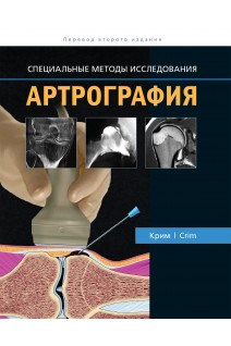 Артрография. Специальные методы исследования. Джулия Р. Крим