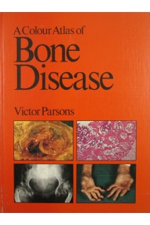 A colour atlas of bone disease. Victor Parsons
