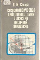 Стереотаксическая гиппокампотомия в лечении височной эпилепсии (БУ). Сакарэ К.М.