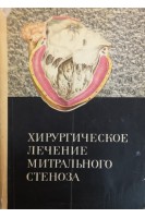 Хирургическое лечение митрального стеноза (БУ). Даниленко М.В.