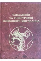 Запалення та гіпертрофія язикового мигдалика. Лайко А.А. Заболотний Д.І. Гавриленко Ю.В.