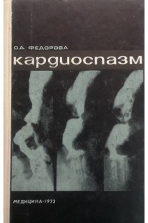 Кардиоспазм (БУ). Федорова О.Д.