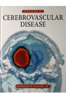 Principles of Cerebrovascular Disease. Harold Adams