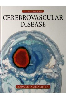 Principles of Cerebrovascular Disease. Harold Adams