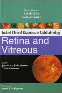 Retina and Vitreous (Instant Clinical Diagnosis in Opthalmology) . Jose Maria Ruiz Moreno and T. Mark Johnson