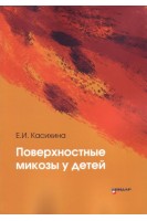 Поверхностные микозы у детей. Касихина Е.И.